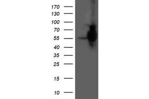 HEK293T cells were transfected with the pCMV6-ENTRY control (Left lane) or pCMV6-ENTRY HARS2 (Right lane) cDNA for 48 hrs and lysed. (HARS2 antibody)