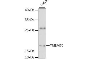 Western blot analysis of extracts of HeLa cells, using TMEM70 antibody (ABIN6294170) at 1:3000 dilution. (Transmembrane Protein 70 (TMM70) antibody)