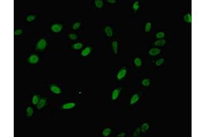 Immunofluorescent analysis of Hela cells using ABIN7142846 at dilution of 1:100 and Alexa Fluor 488-congugated AffiniPure Goat Anti-Rabbit IgG(H+L) (NIP7 antibody  (AA 1-180))