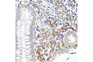Immunohistochemistry of paraffin-embedded human appendix using Sec23AA Rabbit mAb (ABIN7270168) at dilution of 1:100 (40x lens). (SEC23A antibody)
