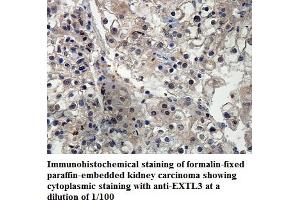 Image no. 1 for anti-Exostoses (Multiple)-Like 3 (EXTL3) antibody (ABIN1576398) (EXTL3 antibody)