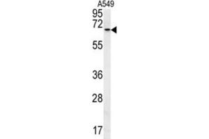 Western Blotting (WB) image for anti-DEXH (Asp-Glu-X-His) Box Polypeptide 58 (DHX58) antibody (ABIN3002344) (DHX58 antibody)