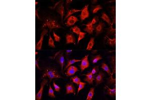 Immunofluorescence analysis of NIH/3T3 cells using ENO2 antibody. (ENO2/NSE antibody  (AA 195-434))