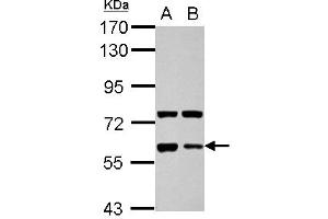 Western Blotting (WB) image for anti-Glypican 5 (GPC5) (AA 37-352) antibody (ABIN1498501) (GPC5 antibody  (AA 37-352))