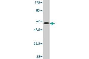Western Blot detection against Immunogen (61. (Ribokinase antibody  (AA 1-322))