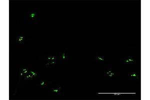 Immunofluorescence of purified MaxPab antibody to RBM19 on HeLa cell. (RBM19 antibody  (AA 1-960))