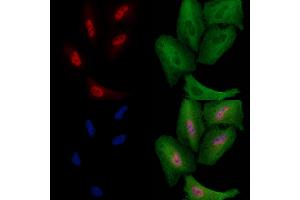 ABIN6259975 and ABIN6278551 staining  cells by IF/ICC. (CDC23 antibody  (Internal Region))