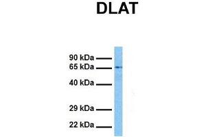 Host:  Rabbit  Target Name:  DLAT  Sample Tissue:  Human Jurkat  Antibody Dilution:  1. (DLAT antibody  (N-Term))