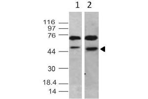 Image no. 1 for anti-TBP-Like 1 (TBPL1) antibody (ABIN5027796) (TBPL1 antibody)