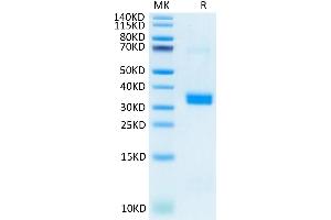Human APOE on Tris-Bis PAGE under reduced condition. (ApoE3 Protein (AA 19-317) (His tag))