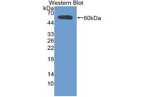 Western Blotting (WB) image for anti-Deiodinase, Iodothyronine, Type II (DIO2) (AA 30-259) antibody (ABIN1858636) (DIO2 antibody  (AA 30-259))