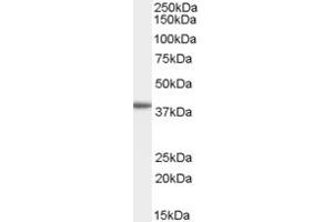 Western Blotting (WB) image for anti-ADP-Ribosylation Factor-Like 9 (ARL9) (C-Term) antibody (ABIN2789237)