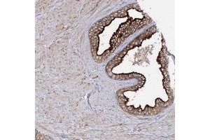 Immunohistochemical staining of human prostate with SYTL1 polyclonal antibody  shows strong cytoplasmic and membranous positivity in glandular cells. (SYTL1 antibody)