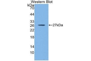 Western Blotting (WB) image for anti-C-Reactive Protein (CRP) (AA 17-224) antibody (ABIN1858505) (CRP antibody  (AA 17-224))