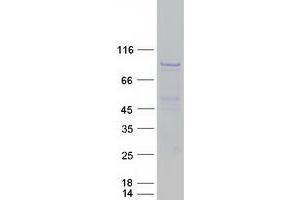 Validation with Western Blot