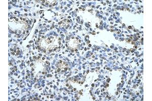 Immunohistochemistry (IHC) image for anti-Squalene Epoxidase (SQLE) (C-Term) antibody (ABIN2777142)