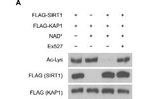 SIRT1 deacetylates KAP1 in vitro and in vivo. (Acetylated Lysine antibody)
