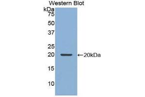 Western Blotting (WB) image for anti-Nucleoporin 210kDa (NUP210) (AA 1149-1295) antibody (ABIN1860082) (NUP210 antibody  (AA 1149-1295))