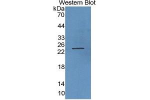 WB of Protein Standard: different control antibodies against Highly purified E. (Growth Hormone 1 CLIA Kit)