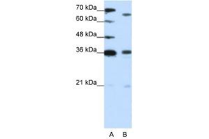 PRDM13 antibody (20R-1222) used at 1.
