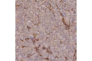 Immunohistochemical staining of human pancreas with ARRDC1 polyclonal antibody  shows distinct cytoplasmic positivity in ducts. (ARRDC1 antibody)