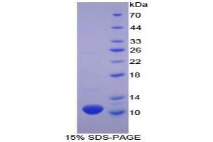 SDS-PAGE analysis of Human beta Thromboglobulin Protein. (beta-Thromboglobulin Protein (beta-TG))