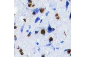 Immunohistochemistry (IHC) image for anti-SRY (Sex Determining Region Y)-Box 2 (SOX2) antibody (ABIN7308362) (SOX2 antibody)