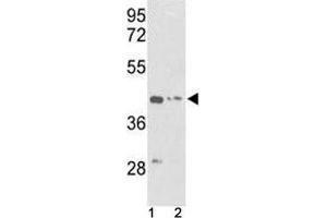 Western blot analysis of g-Actin antibody and (1) K562 and (2) HepG2 lysate (Actin, gamma 1 antibody  (AA 188-215))