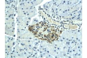 Formalin-fixed and paraffin embedded rat pancreas labeled with Anti-SSTR3 Polyclonal Antibody, Unconjugated (ABIN685552) followed by conjugation to the secondary antibody and DAB staining (SSTR3 antibody)