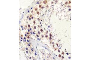 Paraformaldehyde-fixed, paraffin embedded human testis tissue, Antigen retrieval by boiling in sodium citrate buffer (pH6. (TBP antibody)
