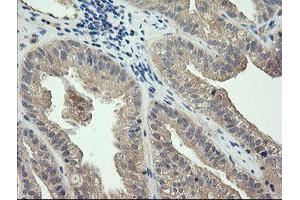 Image no. 2 for anti-Cancer/testis Antigen 1B (CTAG1B) antibody (ABIN1499892) (CTAG1B antibody)