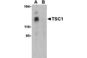 Western blot analysis of TSC1 in EL4 cell lysate with this product at 1 μg/ml in the (A) absence and (B) presence of blocking peptide. (TSC1 antibody  (both Isoforms, Middle Region))