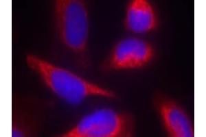 Image no. 1 for anti-Nitric Oxide Synthase 3 (Endothelial Cell) (NOS3) (Thr863) antibody (ABIN401626)