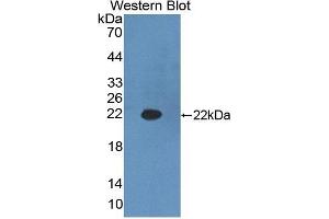 Detection of Recombinant HADH, Mouse using Polyclonal Antibody to Hydroxyacyl Coenzyme A Dehydrogenase (HADH) (HADH antibody  (AA 1-167))