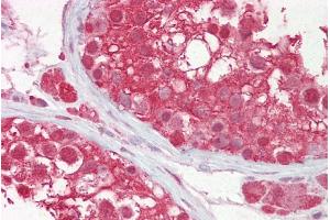 Immunohistochemistry with Testis tissue at an antibody concentration of 10µg/ml using anti-CUL3 antibody (ARP61264_P050) (Cullin 3 antibody  (C-Term))