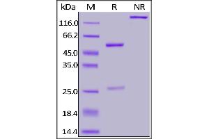 Anti-SARS-CoV-2 Nucleocapsid Antibody, Human IgG1 on SDS-PAGE under reducing (R) condition. (SARS-CoV-2 Nucleocapsid antibody)