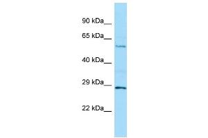 WB Suggested Anti-MINPP1 Antibody Titration: 1. (MINPP1 antibody  (C-Term))