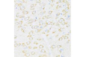 Immunohistochemistry of paraffin-embedded mouse brain using DDX3Y antibody (ABIN6130260, ABIN6139496, ABIN6139497 and ABIN6215395) at dilution of 1:100 (40x lens). (DDX3Y antibody  (AA 1-210))