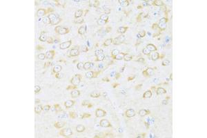 Immunohistochemistry of paraffin-embedded mouse brain using DDX3Y antibody (ABIN6130260, ABIN6139496, ABIN6139497 and ABIN6215395) at dilution of 1:100 (40x lens). (DDX3Y antibody  (AA 1-210))