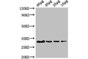 Western Blot Positive WB detected in: Rosseta bacteria lysate at 80 μg, 40 μg, 20 μg, 10 μg All lanes: eutC antibody at 3 μg/mL Secondary Goat polyclonal to rabbit IgG at 1/50000 dilution predicted band size: 32 kDa observed band size: 32 kDa (EUTC (AA 1-295) antibody)