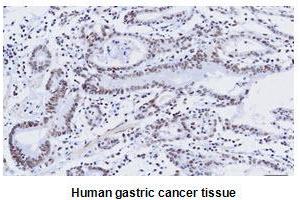 Immunohistochemistry (IHC) image for anti-Kruppel-Like Factor 4 (Gut) (KLF4) (AA 1-170), (N-Term) antibody (ABIN336104) (KLF4 antibody  (N-Term))