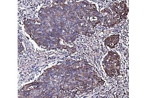 IHC analysis of EGFR using anti-EGFR antibody (ABIN7599622).