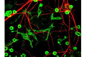 Mixed neuron glia cultures stain with INA antibody (red) and counterstained with rabbit polyclonal antibody to Coronin 1a, (green) which is an excellent marker of microglia and lymphocytes. (INA antibody)