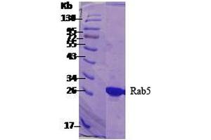 SDS-PAGE of 26 kDa human Rab5 protein (ABIN1686702, ABIN1686703 and ABIN1686704).