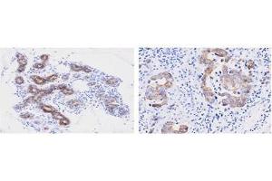 Immunohistochemistry (IHC) image for anti-Peptidylprolyl Isomerase F (PPIF) (AA 30-207) antibody (ABIN356237) (PPIF antibody  (AA 30-207))