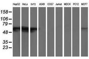 Image no. 2 for anti-Glucosidase, Beta, Acid 3 (Cytosolic) (GBA3) (AA 1-150), (AA 370-469) antibody (ABIN1490586) (GBA3 antibody  (AA 1-150, AA 370-469))