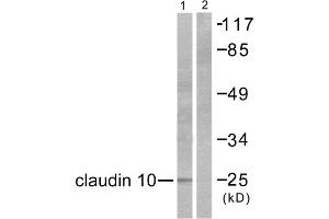 Western Blotting (WB) image for anti-Claudin 10 (CLDN10) (C-Term) antibody (ABIN1848466)