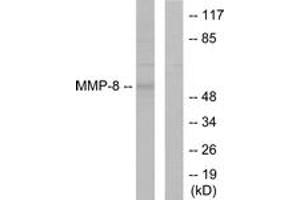 Western blot analysis of extracts from NIH-3T3 cells, using MMP-8 Antibody. (MMP8 antibody  (AA 418-467))