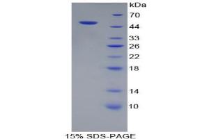 SDS-PAGE analysis of Human PSMC3 Protein.
