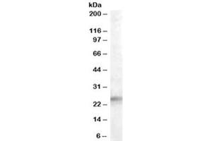 Western blot testing of human adrenal gland lysate with IGFBP6 antibody at 0. (IGFBP6 antibody)